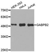 Western blot analysis of extracts of various cell lines, using GABPB2 antibody.