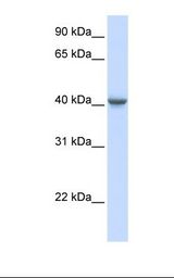721_B cell lysate. Antibody concentration: 1.0 ug/ml. Gel concentration: 12%.