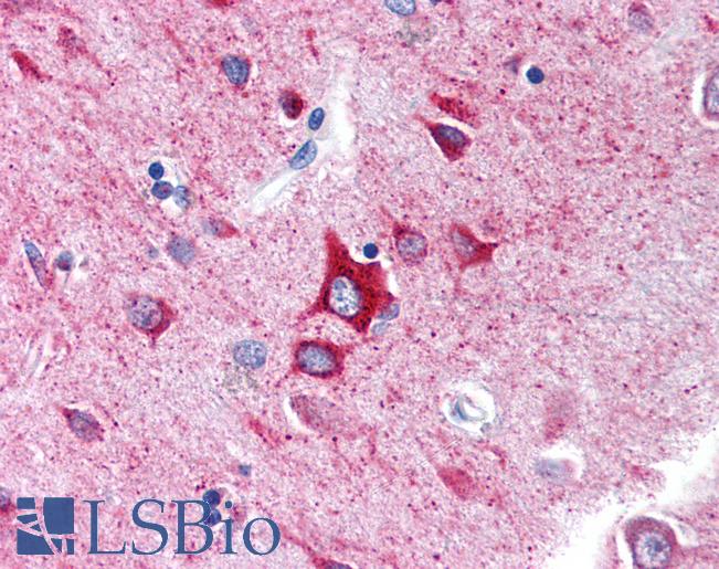 Anti-GABRA1 antibody IHC of human brain, cortex. Immunohistochemistry of formalin-fixed, paraffin-embedded tissue after heat-induced antigen retrieval. Antibody LS-B155 concentration 2.5 ug/ml.