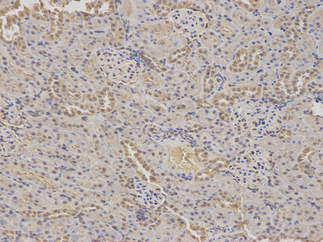 Immunohistochemistry of paraffin-embedded rat kidney using GABRA2 antibody at dilution of 1:100 (200x lens).