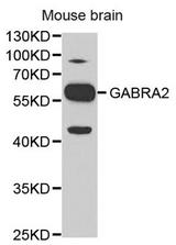 Western blot analysis of extracts of mouse brain, using GABRA2 antibody.