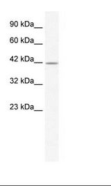 Jurkat Cell Lysate