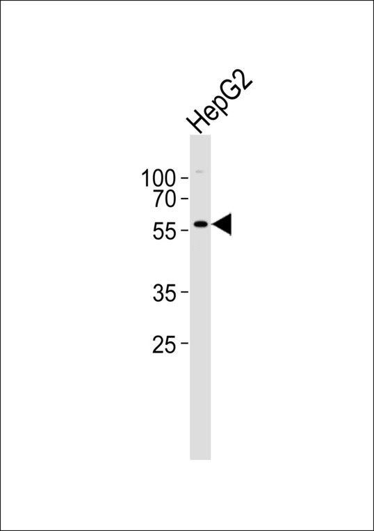 Western blot of lysate from HepG2 cell line with GABRA3 Antibody. Antibody was diluted at 1:1000. A goat anti-rabbit IgG H&L (HRP) at 1:5000 dilution was used as the secondary antibody. Lysate at 35 ug.