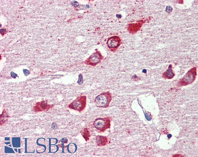 Anti-GABRA3 antibody IHC of human brain, cortex. Immunohistochemistry of formalin-fixed, paraffin-embedded tissue after heat-induced antigen retrieval. Antibody LS-B4146 concentration 2.5 ug/ml.