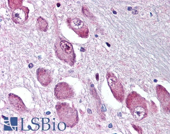 Anti-GABRA3 antibody LS-A9667 IHC of human brain, basal nucleus of Meynert. Immunohistochemistry of formalin-fixed, paraffin-embedded tissue after heat-induced antigen retrieval.