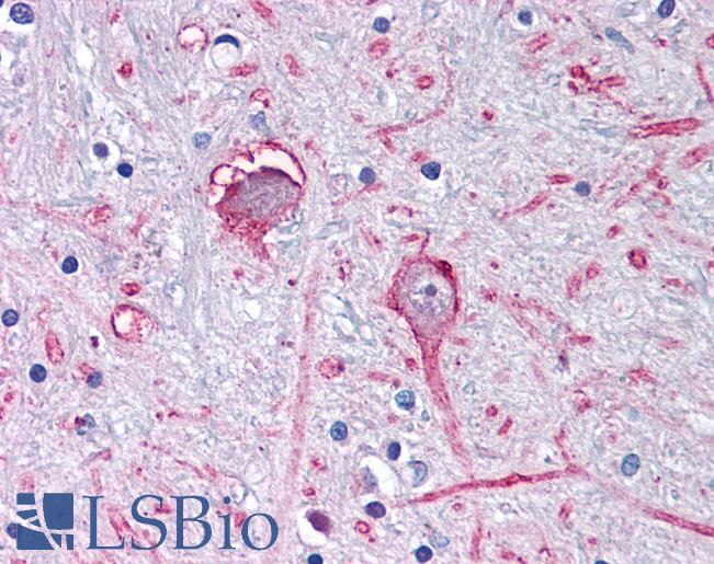 Anti-GABRA3 antibody LS-A9666 IHC of human brain, globus pallidus. Immunohistochemistry of formalin-fixed, paraffin-embedded tissue after heat-induced antigen retrieval.