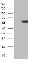 HEK293T cells were transfected with the pCMV6-ENTRY control (Left lane) or pCMV6-ENTRY GABRA5 (Right lane) cDNA for 48 hrs and lysed. Equivalent amounts of cell lysates (5 ug per lane) were separated by SDS-PAGE and immunoblotted with anti-GABRA5.