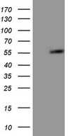 HEK293T cells were transfected with the pCMV6-ENTRY control (Left lane) or pCMV6-ENTRY GABRA5 (Right lane) cDNA for 48 hrs and lysed. Equivalent amounts of cell lysates (5 ug per lane) were separated by SDS-PAGE and immunoblotted with anti-GABRA5.
