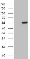 HEK293T cells were transfected with the pCMV6-ENTRY control (Left lane) or pCMV6-ENTRY GABRA5 (Right lane) cDNA for 48 hrs and lysed. Equivalent amounts of cell lysates (5 ug per lane) were separated by SDS-PAGE and immunoblotted with anti-GABRA5.