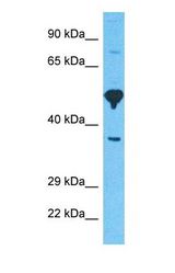 Western blot of GBRA6 Antibody with human 293T Whole Cell lysate.