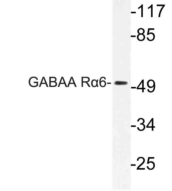 Western blot of GABAA R6 (P97) pAb in extracts from Jurkat cells.