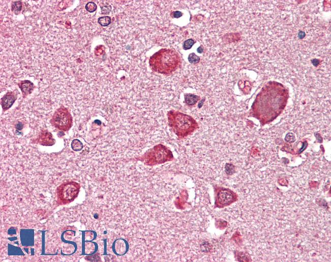 Anti-GABRA6 antibody IHC staining of human brain, cortex. Immunohistochemistry of formalin-fixed, paraffin-embedded tissue after heat-induced antigen retrieval. Antibody LS-B10335 concentration 5 ug/ml.