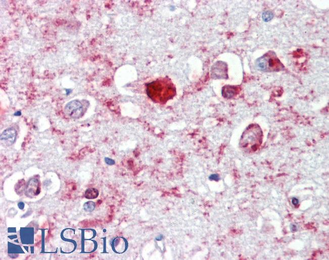 Anti-GABRA6 antibody IHC of human brain, cortex. Immunohistochemistry of formalin-fixed, paraffin-embedded tissue after heat-induced antigen retrieval. Antibody LS-B3612 concentration 2.5 ug/ml.