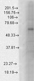 Western blot analysis of GABA(A)R, Beta1 in a human cell line mix using a 1:1000 dilution of GABRB1 antibody.
