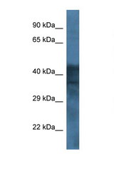 GABRB1 antibody LS-C134914 Western blot of 8226 Cell lysate. Antibody concentration 1 ug/ml.