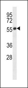 GABRB2 Antibody western blot of A549 cell line lysates (35 ug/lane). The GABRB2 antibody detected the GABRB2 protein (arrow).