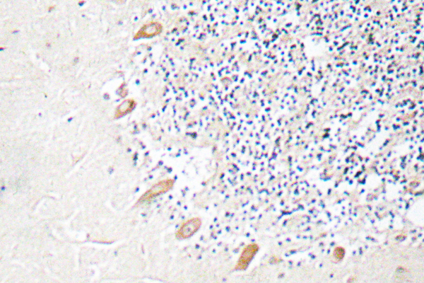 IHC of GABAA R2 (R431) pAb in paraffin-embedded human brain tissue.