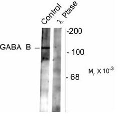 Western blot of rat synaptic membrane showing specific immunolabeling of the ~102 k GABAB R2 protein phosphorylated at Ser783 (control). The phosphospecificity of this labeling is shown in the second lane (lambda-phosphatase: lambda-Ptase). The blot is id