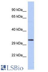 GABRB2 antibody Western Blot of Fetal Spleen. Antibody dilution: 1 ug/ml.