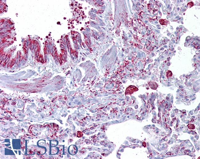 Anti-GABRB3 antibody IHC of human lung. Immunohistochemistry of formalin-fixed, paraffin-embedded tissue after heat-induced antigen retrieval. Antibody LS-B6606 concentration 5 ug/ml.