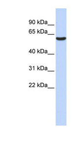 GABRB3 antibody LS-B6606 Western blot of Fetal Liver lysate.