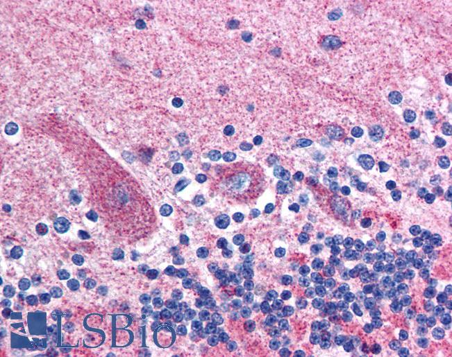 Anti-GABRD antibody IHC of human brain, cerebellum. Immunohistochemistry of formalin-fixed, paraffin-embedded tissue after heat-induced antigen retrieval. Antibody LS-B158 concentration 2.5 ug/ml.