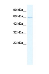 GABRD antibody LS-B158 Western blot of HepG2 Cell lysate. Antibody concentration 1 ug/ml.