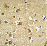 GABRD Antibody IHC of formalin-fixed and paraffin-embedded brain tissue followed by peroxidase-conjugated secondary antibody and DAB staining.