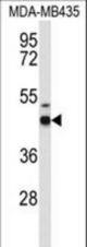 Western blot of GABRD Antibody in MDA-MB435 cell line lysates (35 ug/lane). GABRD (arrow) was detected using the purified antibody.