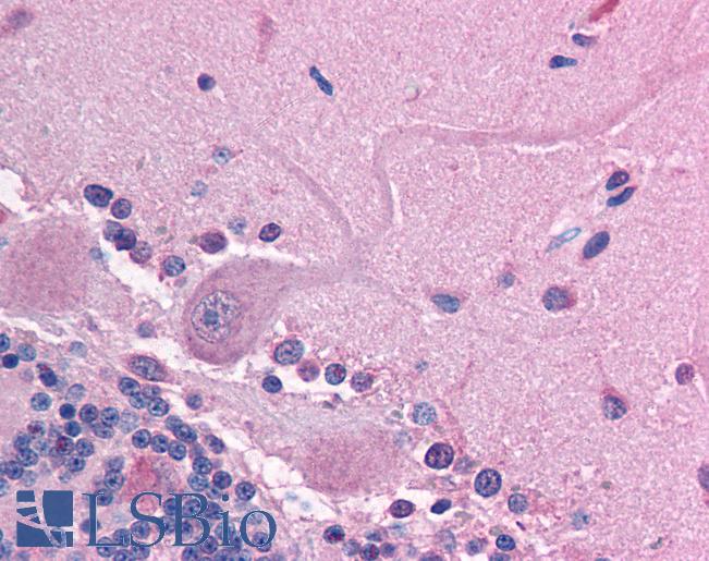 Anti-GABRE antibody IHC of human brain, cerebellum. Immunohistochemistry of formalin-fixed, paraffin-embedded tissue after heat-induced antigen retrieval. Antibody LS-B955 concentration 5 ug/ml.