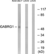 Western blot of extracts from LOVO/RAW264.7 cells, using GABRG1 Antibody. The lane on the right is treated with the synthesized peptide.