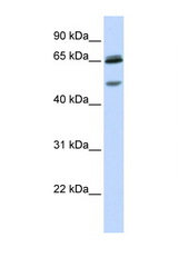 GABRG2 antibody LS-C102839 Western blot of Fetal Brain lysate. Antibody concentration 1 ug/ml.
