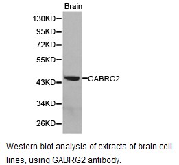 Western blot.