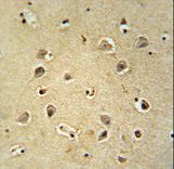 GABRG2 antibody immunohistochemistry of formalin-fixed and paraffin-embedded human brain tissue followed by peroxidase-conjugated secondary antibody and DAB staining.