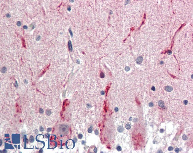 Anti-GABRG2 antibody IHC staining of human brain, cerebellum. Immunohistochemistry of formalin-fixed, paraffin-embedded tissue after heat-induced antigen retrieval. Antibody LS-B11464 concentration 15 ug/ml.