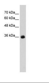 HepG2 Cell Lysate