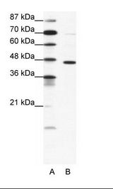 A: Marker, B: Jurkat Cell Lysate