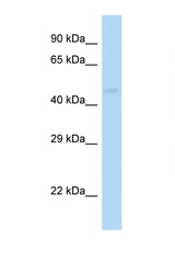 GABRP antibody LS-C145587 Western blot of Mouse Kidney lysate. Antibody concentration 1 ug/ml.