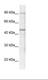 Jurkat Cell Lysate