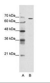 A: Marker, B: Jurkat Cell Lysate