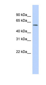 GABRR1 antibody LS-C115960 Western blot of HepG2 cell lysate.