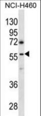 GBRR3 Antibody western blot of NCI-H460 cell line lysates (35 ug/lane). The GBRR3 antibody detected the GBRR3 protein (arrow).