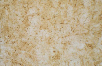 Immunohistochemistry of GABAergic neurons within lamina I of cat dorsal horn using rabbit polyclonal antiserum to glutamic acid decarboxylase (GAD65/67). Photomicrograph courtesy of Dr TFC Batten, Institute for Cardiovascular Research, University of Leeds, UK.