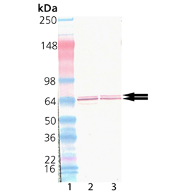 Western blot of Glutamic Acid Decarboxylase pAb: Lane 1: MW Marker, Lane 2: Rat Brain Tissue Extract, Lane 3: Mouse Brain Tissue Extract.
