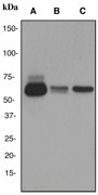 Western blot analysis on (A) fetal brain, (B) mouse brain and (C) rat brain lysates using anti-GAD2 antibody (LS-C105442), dilution 1:1000.