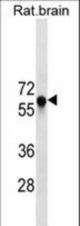 GAD2 Antibody western blot of rat brain tissue lysates (35 ug/lane). The GAD2 antibody detected the GAD2 protein (arrow).