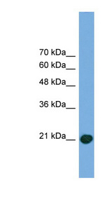 COMMD8 antibody LS-C135421 Western blot of Transfected 293T cell lysate.