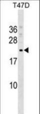 COMMD9 Antibody western blot of T47D cell line lysates (35 ug/lane). The COMMD9 antibody detected the COMMD9 protein (arrow).