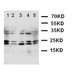 WB of GADD45A / GADD45 antibody. Lane 1: M453 Cell Lysate. Lane 2: M231 Cell Lysate. Lane 3: HELA Cell Lysate. Lane 4: RAJI Cell Lysate. Lane 5: SW620 Cell Lysate.
