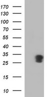 HEK293T cells were transfected with the pCMV6-ENTRY control (Left lane) or pCMV6-ENTRY GADD45A (Right lane) cDNA for 48 hrs and lysed. Equivalent amounts of cell lysates (5 ug per lane) were separated by SDS-PAGE and immunoblotted with anti-GADD45A.